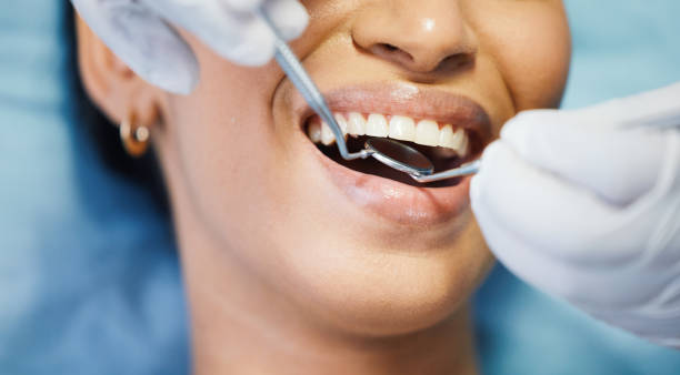 Best Broken or Chipped Tooth Repair in Chocowinity, NC