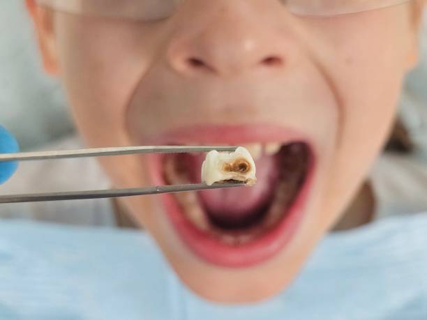 Best Emergency Denture Repair in Chocowinity, NC